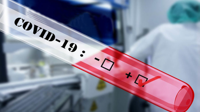 Coronavirus: Mackenna hoy sumó 12 nuevos casos positivos de Covid- 19, en total suma 133 desde el inicio de la pandemia