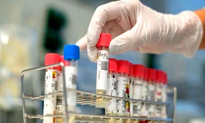 Mackenna superó los 500 contagios de COVID- 19 desde el inicio de la pandemia